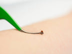 Ecommerce Packaging - TickCheck Premium Tick Remover Kit